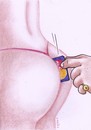 Cartoon: a la card (small) by Petra Kaster tagged sex erotik geld crditkaarten